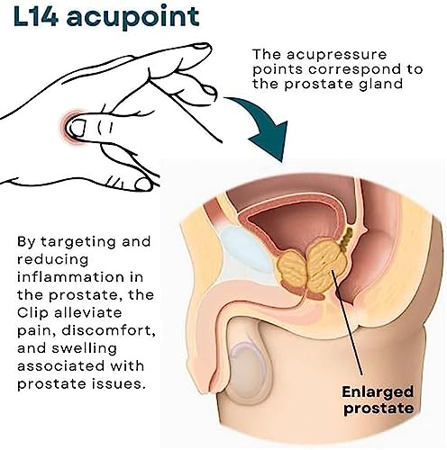 Clip per punto di cura della prostata, clip per