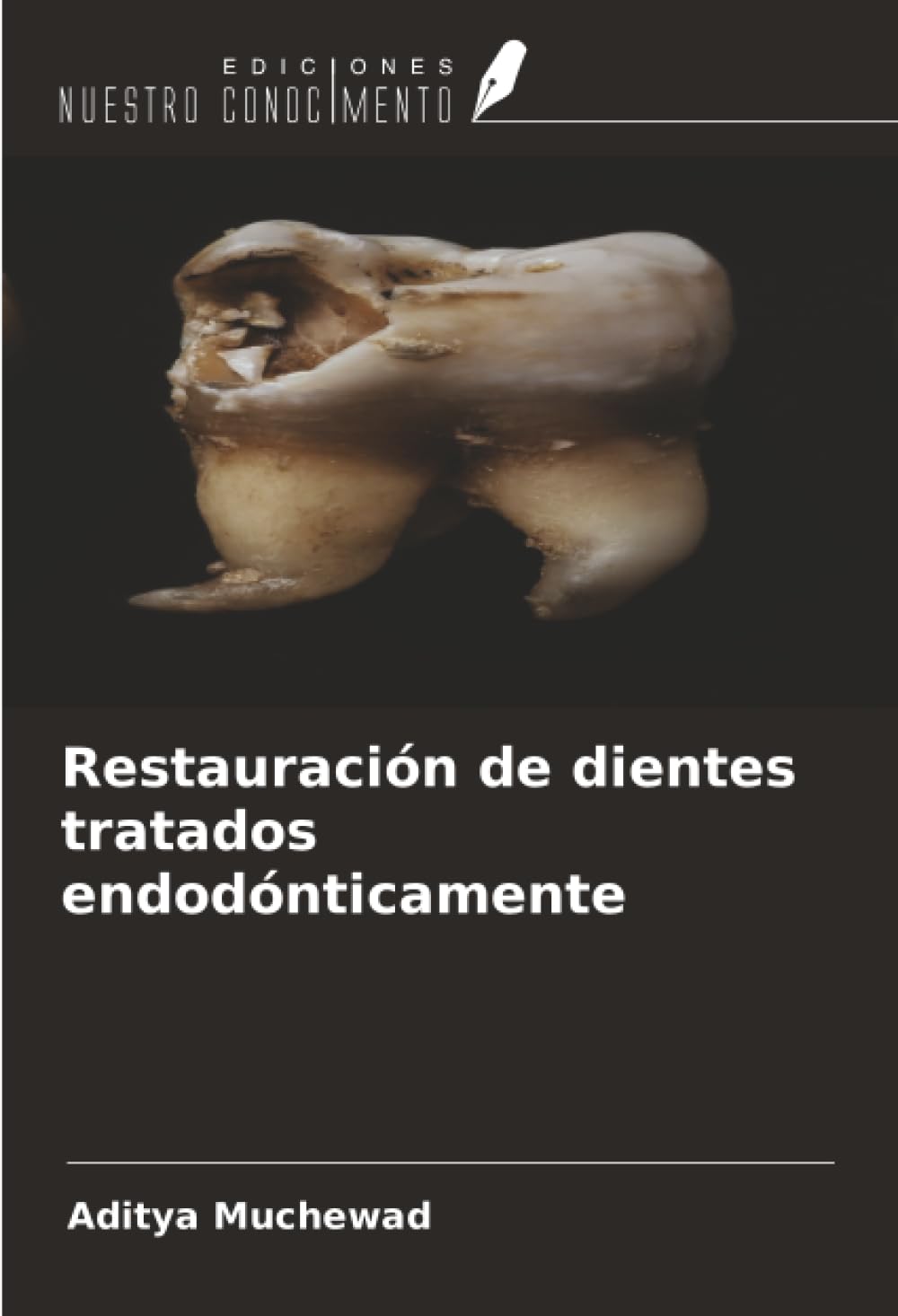 Restauración de dientes tratados endodónticamente