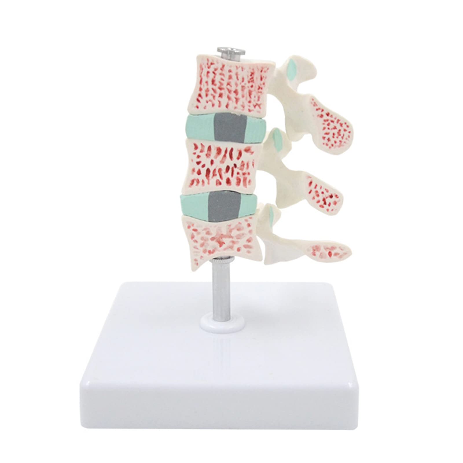 Buy Human Spine Lumbar Vertebrae Model, 3stage Medicals Lumbar Vertebrae Spine Combination of