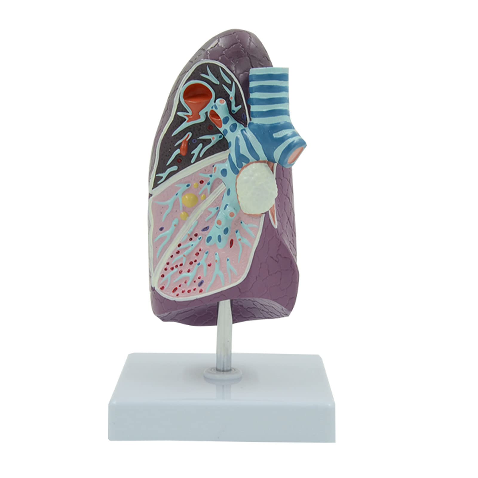 Human Lung Model, Diseased Human Lung Structure Respiratory System Model for Anatomical Study Display Teach Anatomy Medical Supply And Equipment