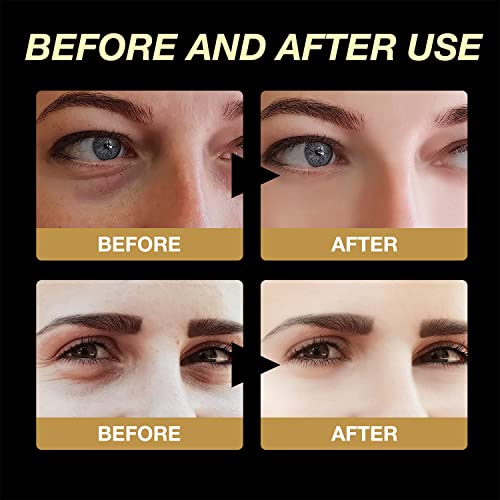 Tptal Instant Firming Eye Cream,Temporary Eye Tightener Eye Cream For Dark Circles Puffiness Remove Eye Bags,Eye Cream Under Eye Treatment,Anti Aging Eye Cream For Wrinkles Reduce Fine Lines (2Pcs) #TOP3