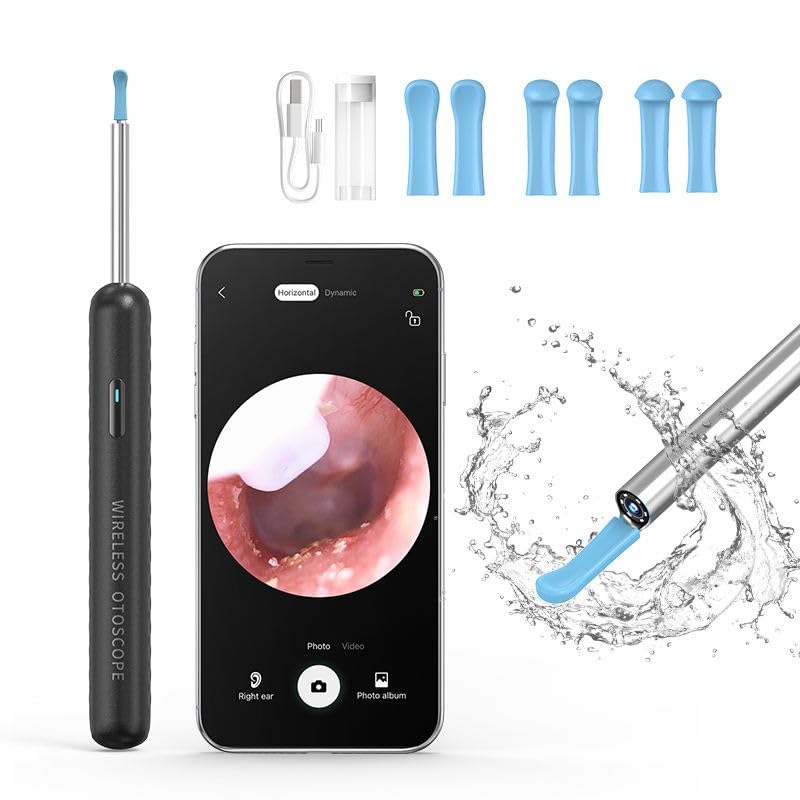Blackpool® Smart pro ear endoscope ear cleaner tool Ear Inspectionl endoscope camera 4.3mm lens mini ear nose otoscope (B0B5ZX42CX) Amazon Price History, Amazon Price Tracker