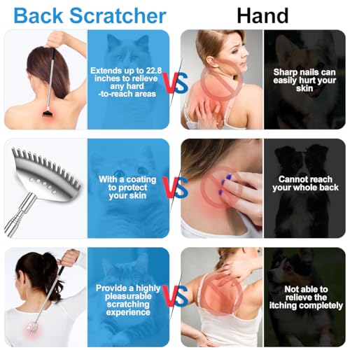 Image of Yeipis 4Pcs Different Back Scratcher Extendable Back Massager Tool with Rubber Handles, Metal Portable Telescoping Back Scratcher, Stocking Stuffers for Men Women Christmas Gift (Black)