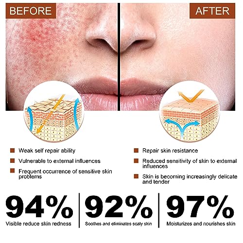 Face Serum Hyaluronic Acid,Face Oil Anti-Aging,Relieve Redness &Quick Sooth Damage Skin,Niacinamide Serum,Replumps & Hydrates,Collagen Face Serum-Protect Skin-Women - Image 4