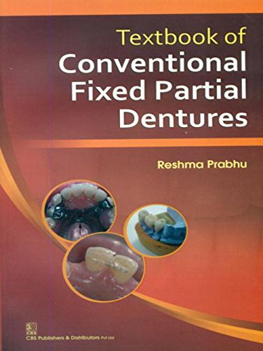 Textbook of Conventional Fixed Partial Dentures