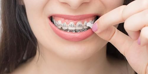 Miniatura 5 de Orthowax - Ceras dentales ortodónticas precortadas (paquete de 18) - Se pega mejor - Cera de ortodoncia de Orthomechanics - Aloe Vera y vitamina E