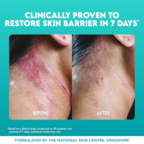 Suu Balm Intense Itch Relief Cream, Anti Itch Lotion for Sensitive Skin, Eczema, Psoriasis & Extreme, Very Severe & Dry Skin, Derm Formula, Menthol & Ceramides, 11.83 fl oz