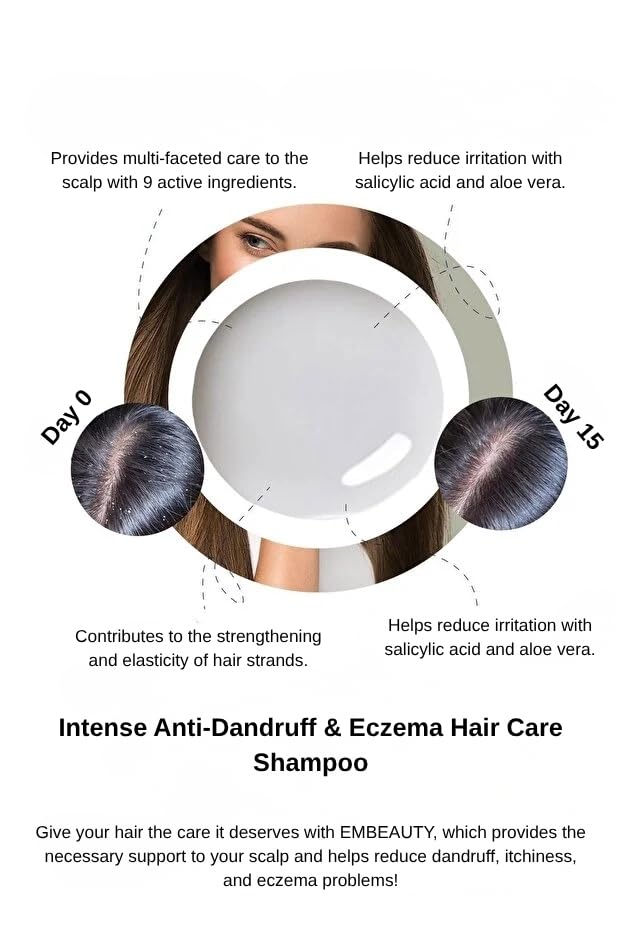 Balancing & Soothing Anti-Flake Shampoo – Supports Relief of Dry, Itchy Scalp, Nourishing 9-Active Formula for a Healthier-Looking Scalp, Salt-Free, Paraben-Free 400 ml / 14 fl oz - Image 3