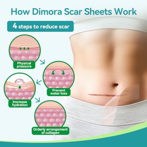 dimora medical grade silicone scar sheets -ultra soft silicone scar tape 16x6034 roll hypoallergenic scar removal treatment for surgical scars c section tummy tuck keloid treatment