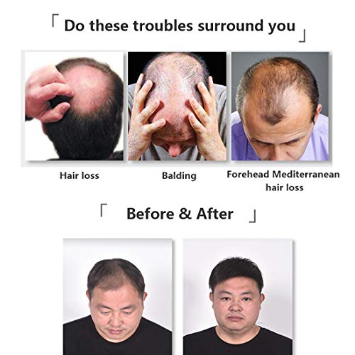 Hand Tied Lace Toupee Human Hair Extension Clip In Hairpieces Topper Top Hair Piece For Men With Hair Loss Natural Black (7.9"X8.7" 2#, Natural Black) #TOP5