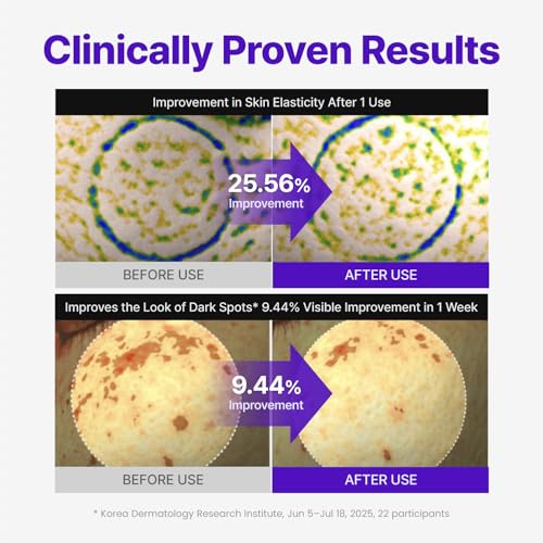 Image of CENTELLIAN 24 Expert Madeca Cream Active Renew PDRN, TECA, Firming