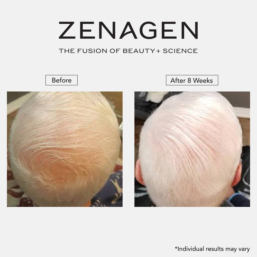 ZENAGEN Revolve Szampon zagęszczający dla mężczyzn, wspiera wygląd pełniejszych, zdrowiej wyglądających włosów, opracowany z myślą o delikatnych i wyraźnie przerzedzających się włosach, na bazie