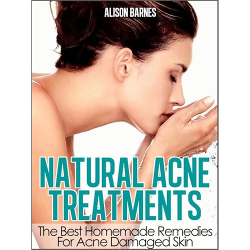 Alison Barnes's Natural Acne Treatments: Home Remedies For An Acne Cure. Treatment of Teenage Acne, Adult Acne, Acne Scars and Back Acne episode artwork