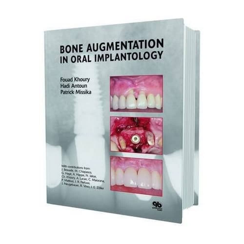 The Fabric of the Modern Implantology 近… Bone and Soft Tissue Augmentation in Implantology | Fouad
