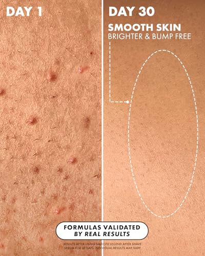 Image of Truly Beauty Smooth Legend After Shave Serum | Reduce Bumps & KP Post-Shave