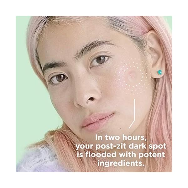 HYPERFADE-by-ZitSticka-Microdart-Patch-to-Fade-Post-Zit-Dark-Spots ZitSticka Hyperfade Acne Patches for Face - World's Most Potent Pimple Patch with Fast-Acting Microdarts - Starts Working within 2 Hours for Deep, Early-Stage Zits & Blemish - 12 Count