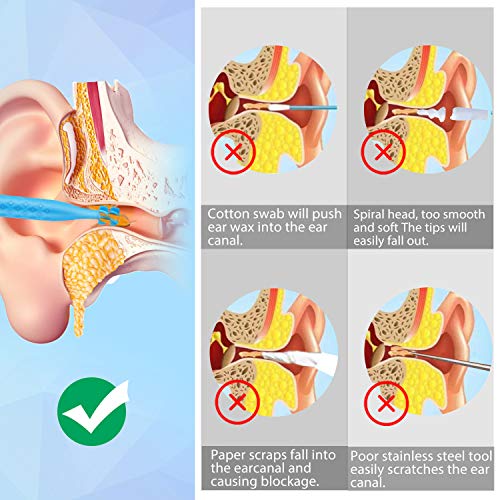 Ear Wax Removal Cleaner Tool Kit, FERNIDA 4 Types Earwax Remover Picks New Turbofan Structure Tech for Complete Ear Cleaning, Efficient Earsafe Design and Portable Storage Box Adults and Kids