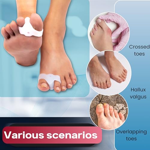 Image of Wonder Care Silicone Toe Separator For Feet Gel Pads Big Toe Corrector Bunion Straightener Yoga Stretcher Hammer Bunion [Pair of 2-4 Pieces]
