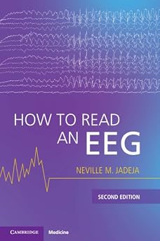 How to Read an EEG