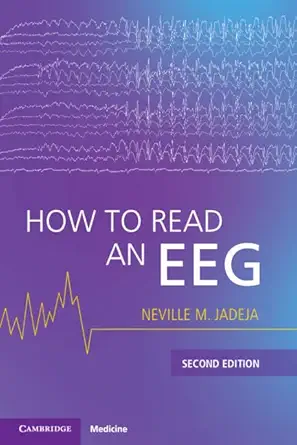 How to Read an EEG 2nd Edition-Wow! eBook
