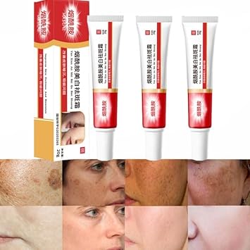 3PCS Crema Para Las Manchas De La Cara, Cremas para Quitar Manchas de La Cara, Face Moisturizer Cream,Adecuado para varias areas como cara, axilas, cuello, zona privade