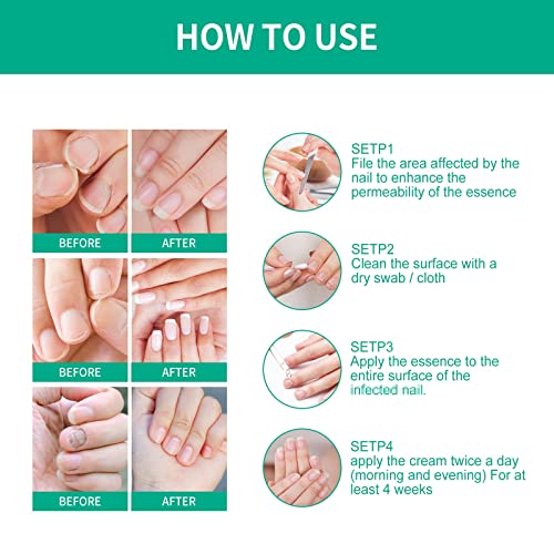 Kerassentials Nails Nutrient Oil(2Pc) #TOP6