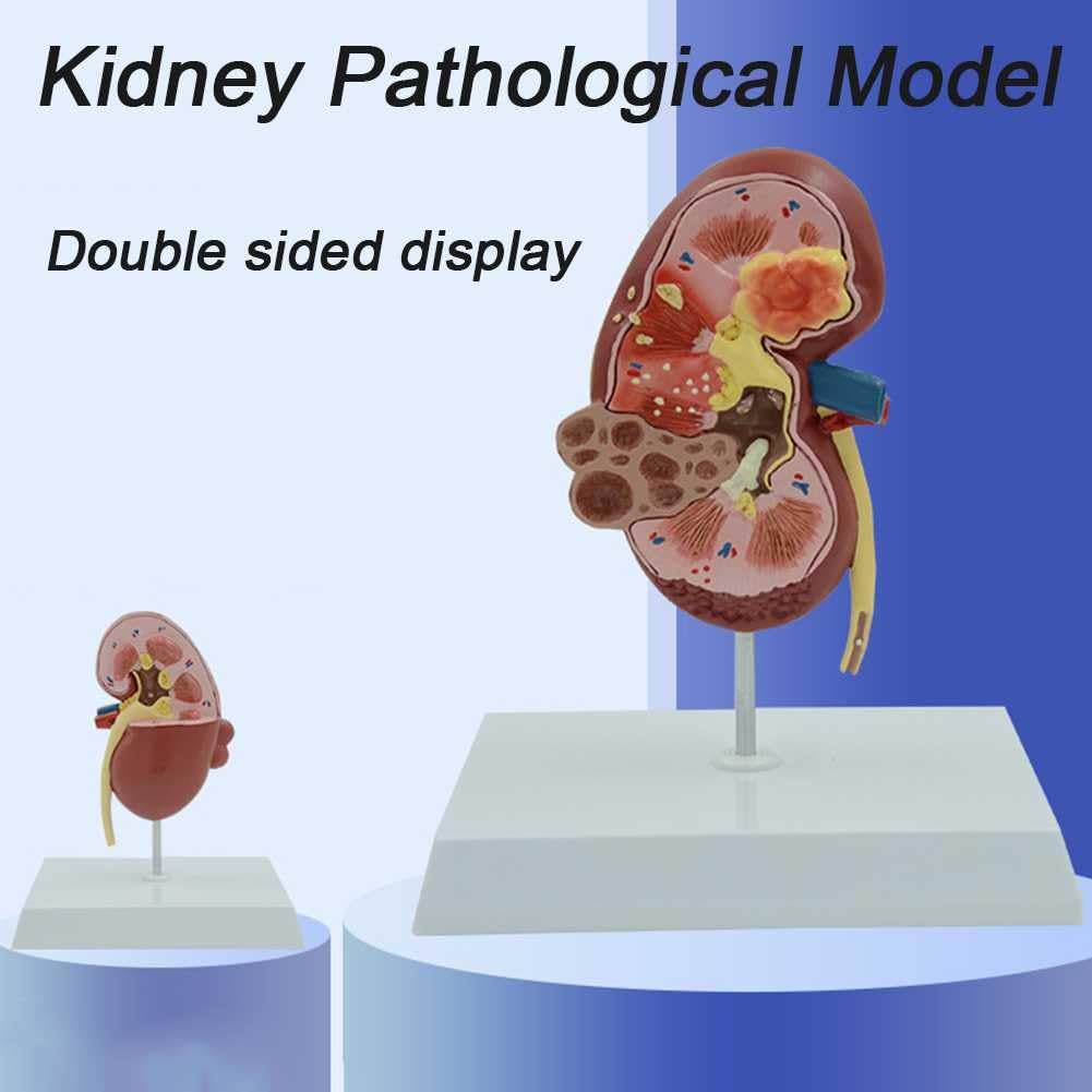 Model Nerki Z 2 Odłączanymi Częściami I 24 Cyfrowymi Etykietami Oraz Instrukcjami Anatomicznymi Dotyczącymi Ułożenia, Pozwalającymi Zrozumieć Strukturę Ludzkiej Nerki