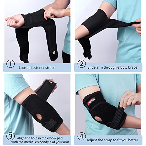 FEATOL Elbow Brace For Tendonitis And Tennis Elbow