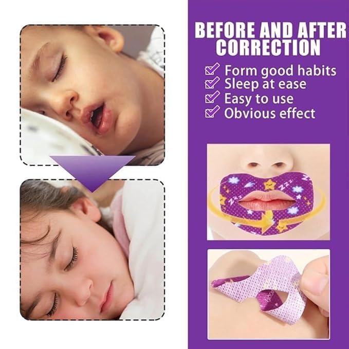 CESITRA Kids Sleep Strips, 30pcs Mouth Shape Anti-Suffocation Design Mouth Tape, Stretchable Mouth Sleep Aid Help Nose Breathing, Sleep Mouth Tape for Snoring 3