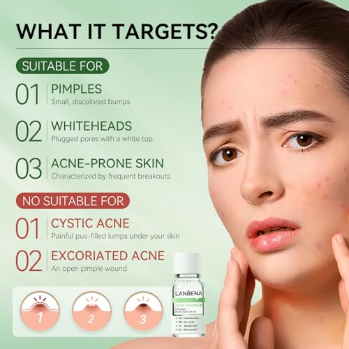 LANBENA Blackhead Remover Mask(1.03 Oz) and Precision Acne Drying Lotion Clean Pore Serum(0.42 Oz)