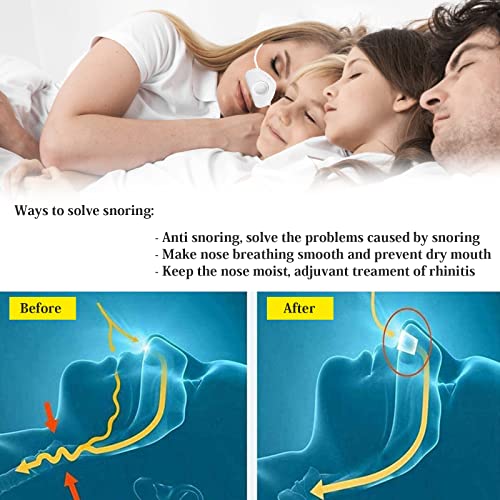 4 in 1 Anti snoring Devices,New Atomization snoring Solution,Right Amount Fog,Adjustable Wind Force Anti snoring Devices for Comfortable Sleep,Improve Your Quality of Life - Thumbnail 6