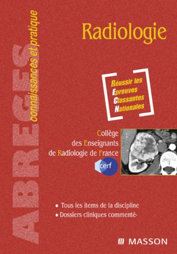 Radiologie (Abrégés connaissances et pratique) PDF Ebook En Ligne