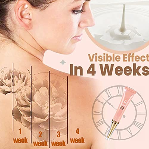 Ardorlove Tattoo Removal Cream, 4 Weeks Painless Safe Tattoo Removal,Safe Moisturize Skin Remover Gel For Tattoo Removal #TOP2
