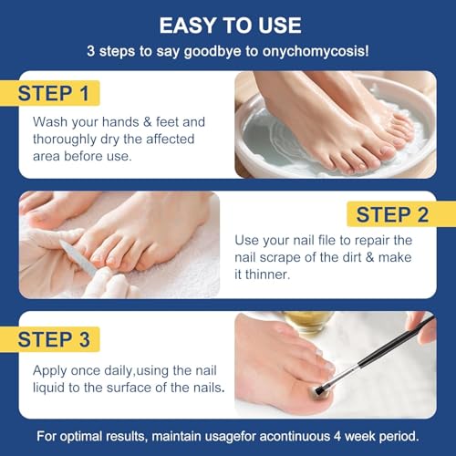 Toenail Fungus Treatment Extra Strength with 25% Undecylenic Acid, Ingrown toenail treatment, nail repair, Fungus nail treatment, yellow toenail, Damaged Nails foot fungus treatment extra strength