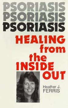 Paperback Psoriasis, Healing from the Inside Out Book