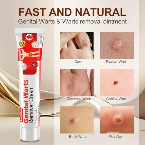 Image of Wart Cream Fast Acting Gel Wart Remover Freeze Off-Fast-Acting Wart's Ointment,genital warts Remover,Foot Warts Corn Removal for Feet Hands for Plantar , Flat , Common , Corn, H Warts, Callus-AAR222