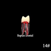 Vista 7 de 8pcs dientes modelo endodoncia endodoncia archivo RCT práctica pulpa para enseñanza estudio