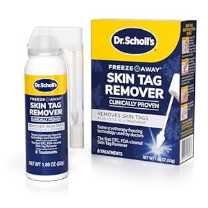 Dr. Scholl’s Freeze Away Skin Tag Remover Kit, 8 ct – Completely removes Skin Tags in As Little As 1 Treatment, FDA-Cleared & Clinically Proven At-Home Removal, Easy 1-Handed Action, Permanent Results