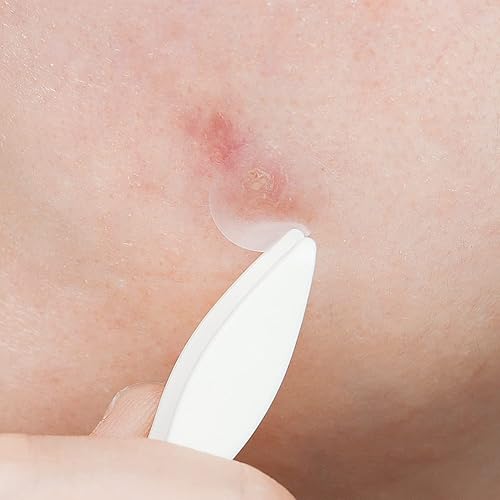 Miniatura 4 de Elizavecca Parche de guardia de CA (0.472 in x 36 EA)  Parche hidrocoloide para acné  Apto para veganos  No probado en animales  parches puntuales