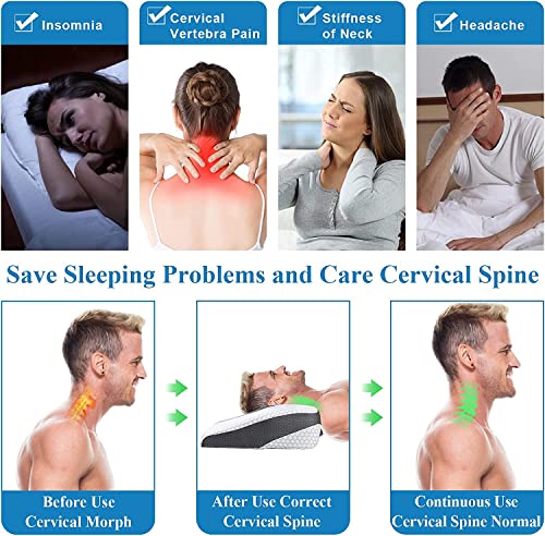 Cervical Memory Foam Pillows For Neck Pain Relief, Neck Pillows For Sleeping, 2 In 1 Orthopedic Pillow, Ergonomic Contour Neck Support Pillow With Cooling Pillowcase #TOP6