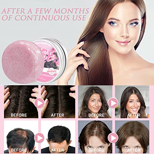 2Pcs Rose Hair Regrowth Shampoo Bar，Anti Hair Loss Shampoo Soap, Natural Organic Rose Shampoo Bar Promotes Hair Growth,Anti-Dandruff And Anti-Itching Rose Bar Soap,Hair Growth Shampoo-For All Hair Type #TOP4