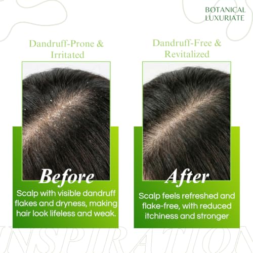 Image of Botanical Luxuriate Amla & Rosemary Anti-Dandruff Shampoo | Paraben Free | Dermatologically Tested | pH Balanced | For Healthy, Dandruff-Free Scalp | 100 ml (Pack of 3, Pack of 3)