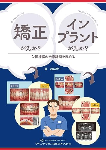 矯正が先か? インプラントが先か?: 欠損補綴の治療計画を極める