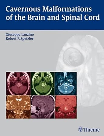 Cavernous Malformations of the Brain and Spinal Cord book cover