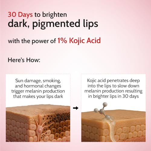 Image of Chemist At Play Tinted Cherry Lip Balm with SPF 50 PA++++ | 1% Kojic Acid | Lip-balm for Dark and Dry Lips | Moisturising Lip Balm for Chapped Lip | Brightens Dark Lips | For Men & Women | 4.5 g