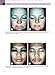 Cosmeceuticals: Procedures in Cosmetic Dermatology Series
