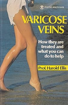Paperback Varicose Veins Book