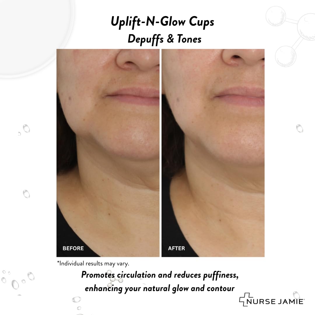 Nurse Jamie Uplift-N-Glow Facial Cupping Tool – Silicone & Glass Cups for Facial Drainage, Product Absorption & Skin Revitalization - Image 5