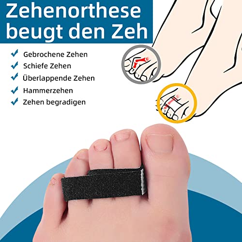 Eurtes 10 Stück Trigger Finger Schiene, Verstellbare Atmungsaktiv Fingerschutz, Fingerbandage für Kleiner Finger, Mittelfinger und Ringfinger, Hammerzehen Korrektoren Uberlappende Zehen Zehenkorrektor
