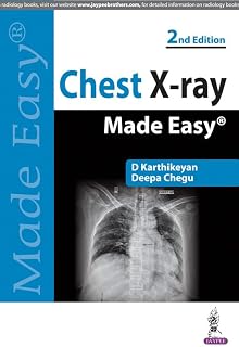Chest X-Ray Made Easy